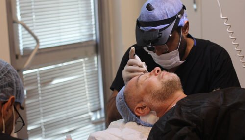 hair-transplant