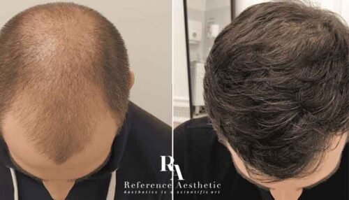 reference-fue-sac-ekim