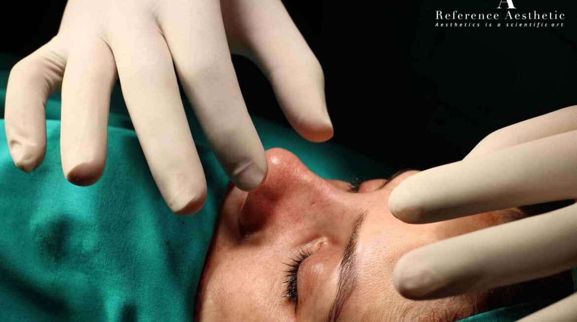 OPEN AND CLOSED RHINOPLASTY