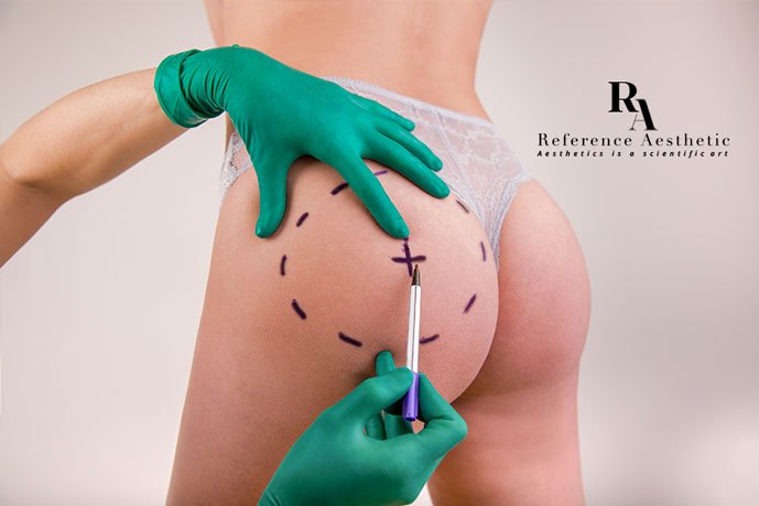 Brazilian Butt Lift Surgery BBL