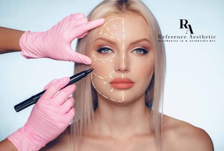 Yanak Estetiği (Bişektomi) Operasyonu