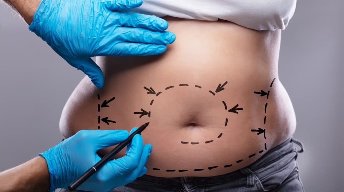 What is j-Plasma Skin Tightening?
