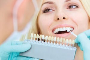 Couronnes laminées et en porcelaine