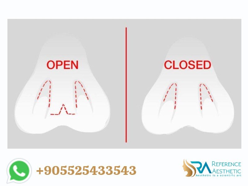 nose-aesthetic-surgery