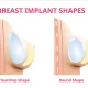 Shaped Implants vs Round in Breast Surgery
