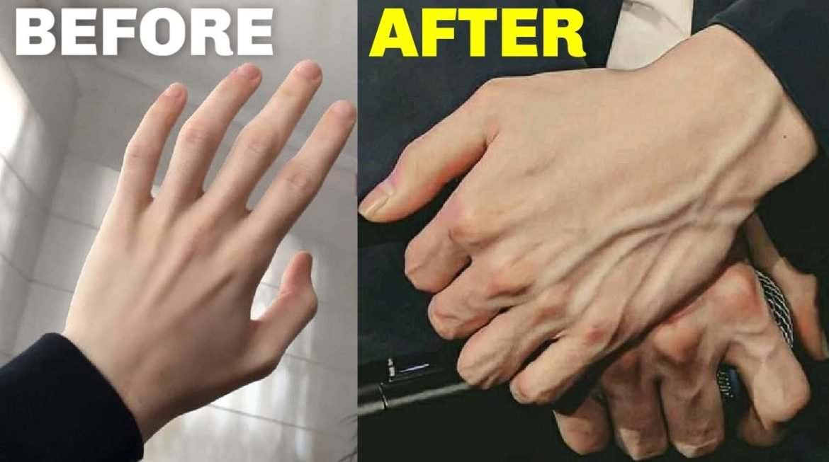 How is Veiny Hands Aesthetic Performed?